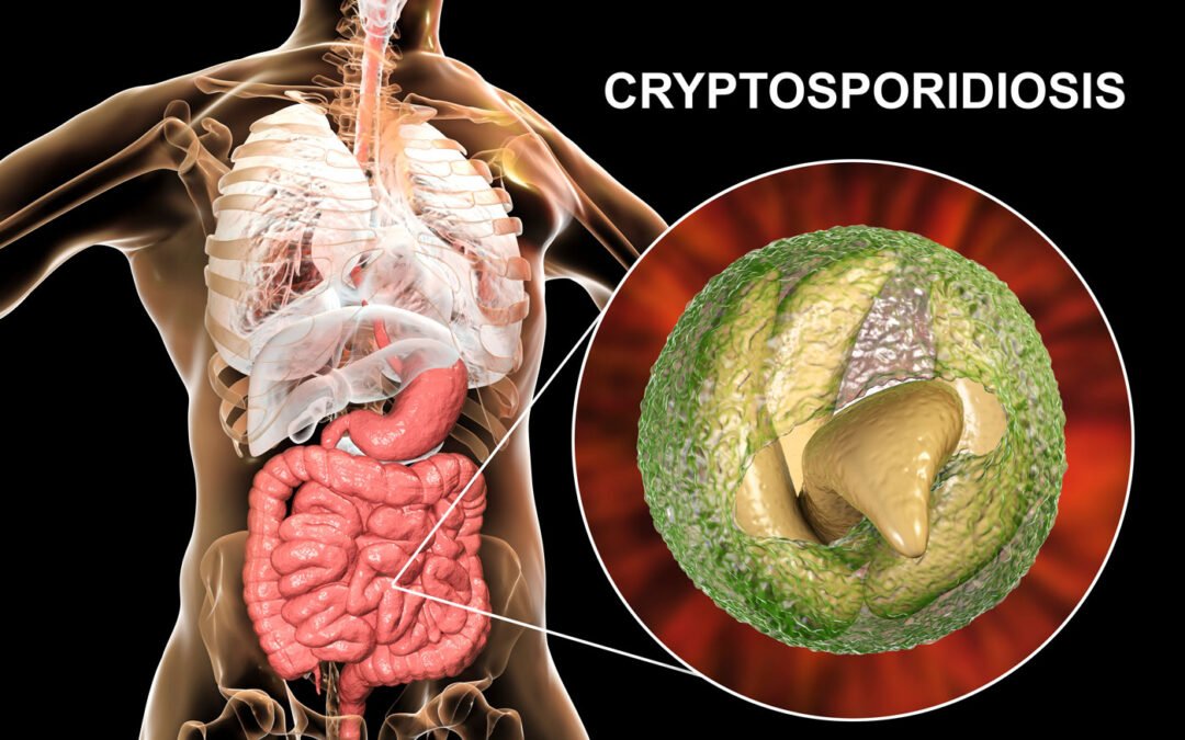 Cryptosporidiosis